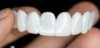 Dental prosthesis