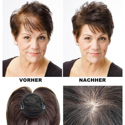 Special head hairpiece